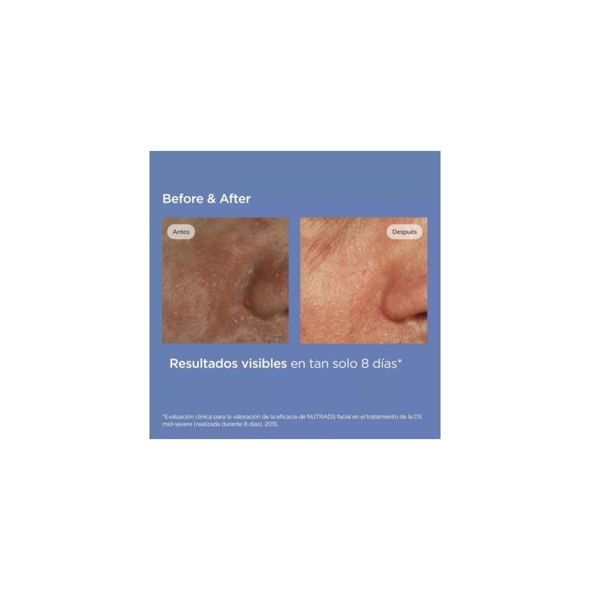 NUTRADEICA GEL CREMA FACIAL 50 ML
