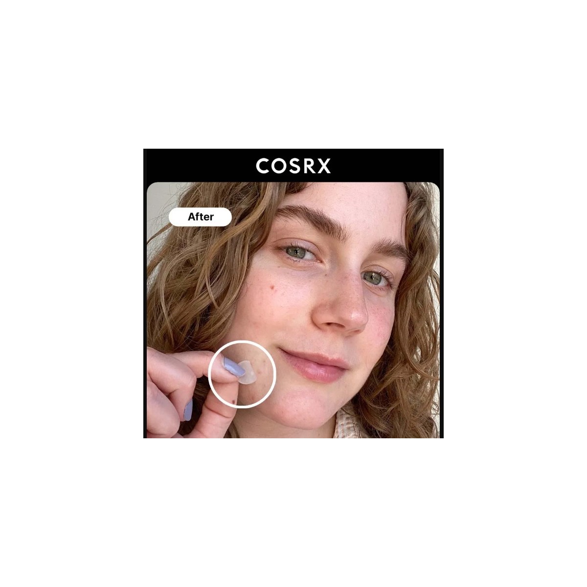 COSRX ACNE PIMPLE MASTER PATCH 24 UNI
