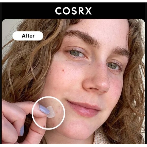 COSRX ACNE PIMPLE MASTER PATCH 24 UNI