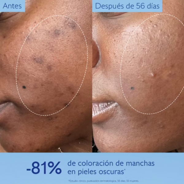 CAUDALIE VINOPERFECT SERUM ANTIMANCHAS 30 ML